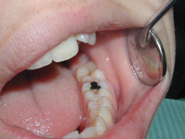Before